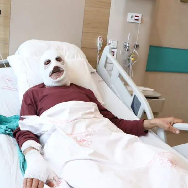 Çakmakla Tüpü Kontrol Etti! Sonrası Faciayla Bitti!